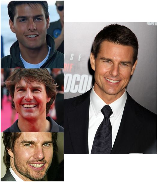tom cruise smile makeover